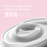 Acne Day Cream ingredients and benefits