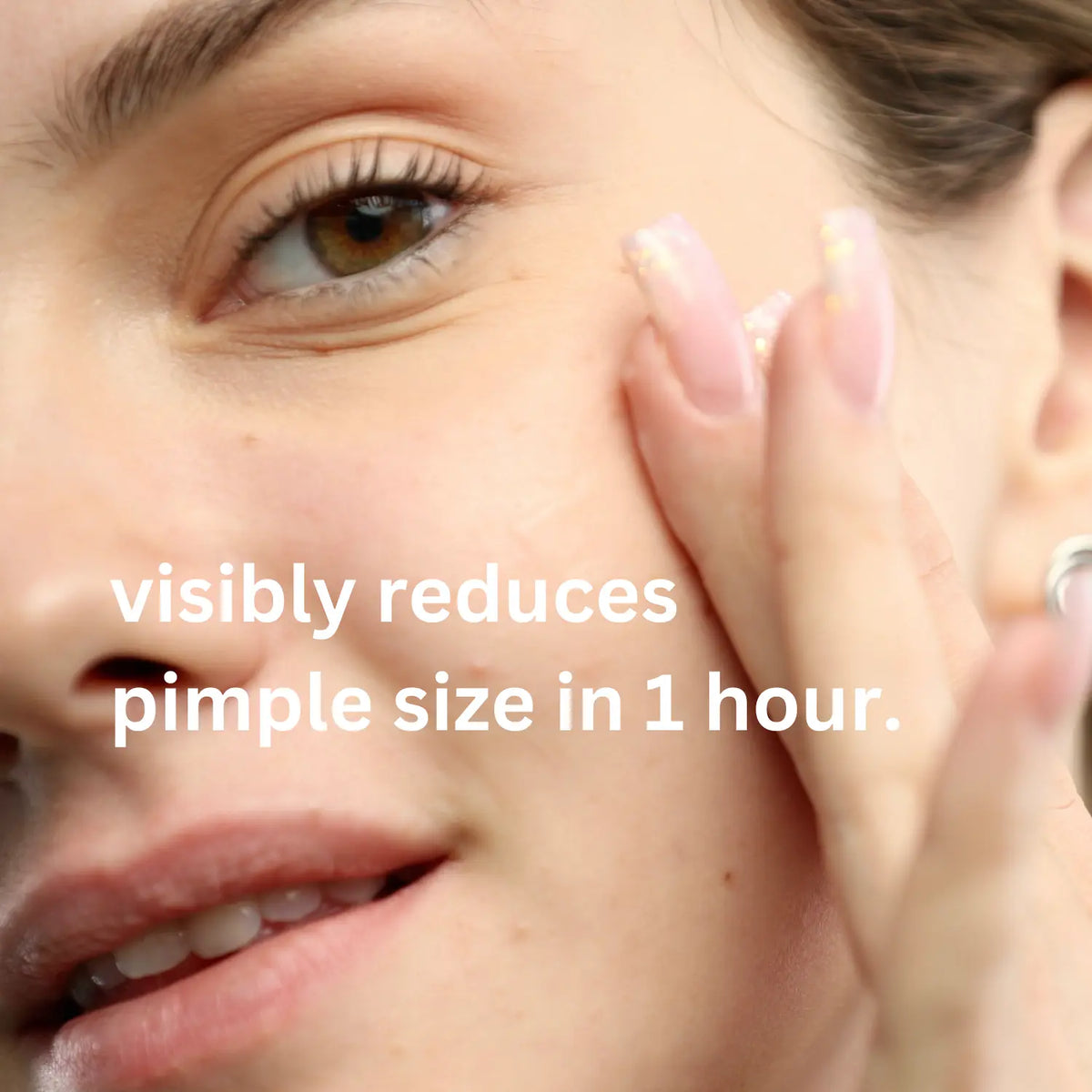 Acne Spot Treatment Hollywoodskin