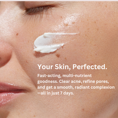 Award Winning〡1% Salicylic Acid Acne Day Cream