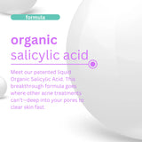 Acne Treatment Set Hollywoodskin