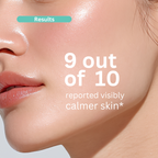 Sérum à 10 % d'acide azélaïque