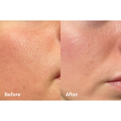 5 % vitamin B5〡Glöd- och fuktgivande serum