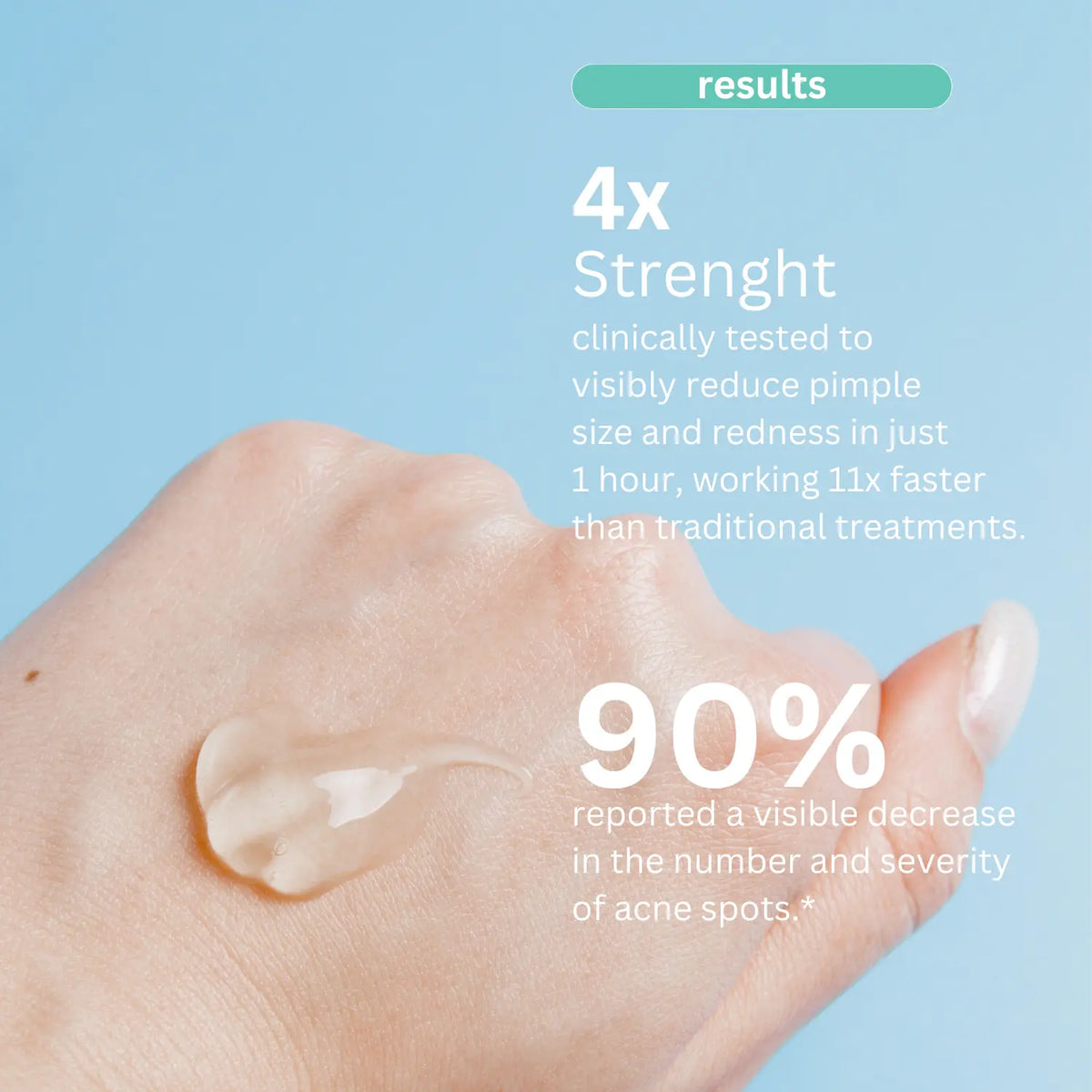 Acne Spot Treatment Hollywoodskin
