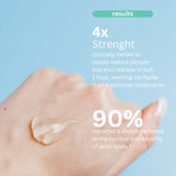 Acne Spot Treatment Hollywoodskin