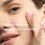 Acne Spot Treatment Hollywoodskin